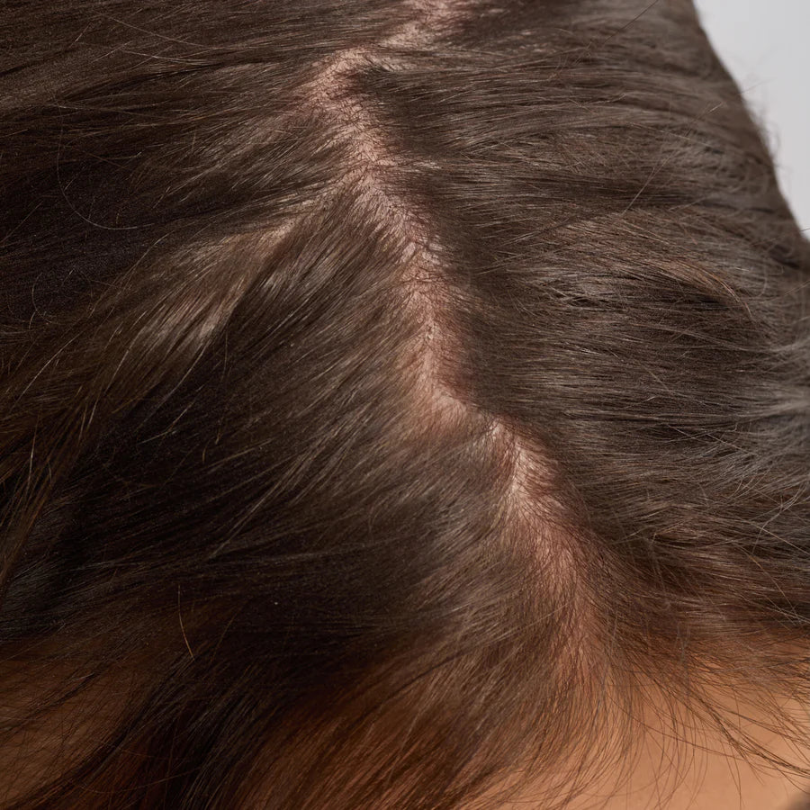 Strengthening Rosemary & Biotin Scalp & Hair Oil